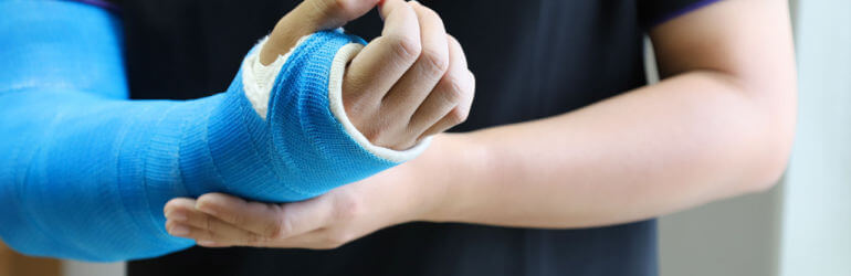 broken bone at work