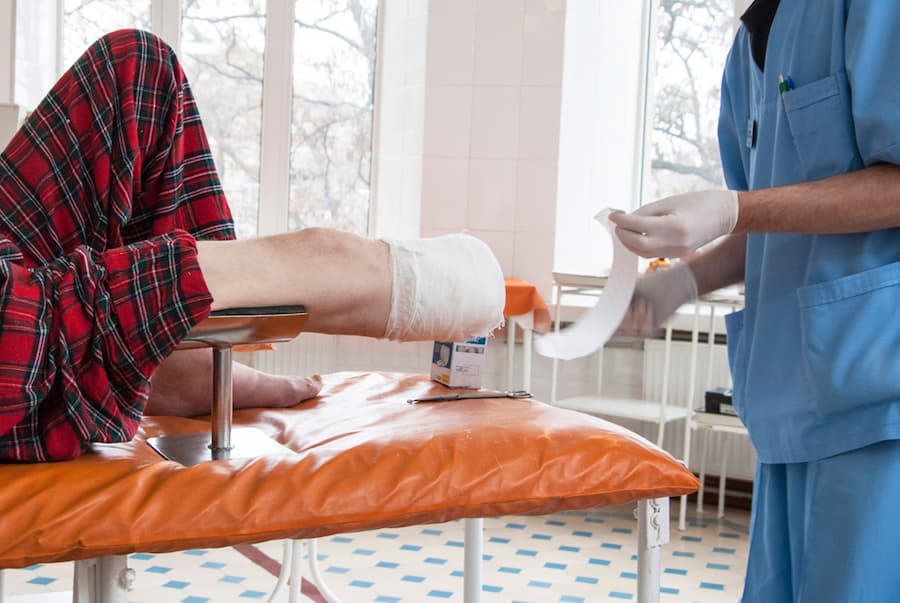 patient with amputated leg